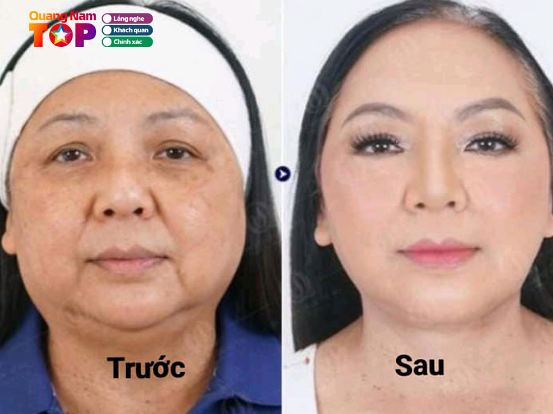 Tham-my-dr-minh-dao-quangnamtoplist