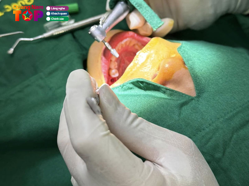 Nha-khoa-quoc-te-a-chau-ii-quangnamtoplist