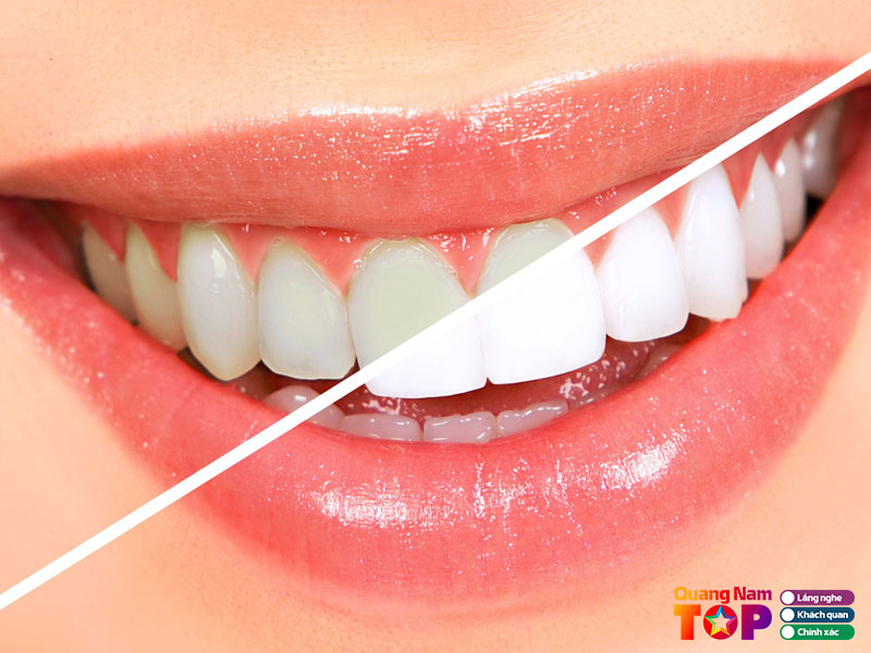 Nha-khoa-sai-gon-medic-quangnamtoplist