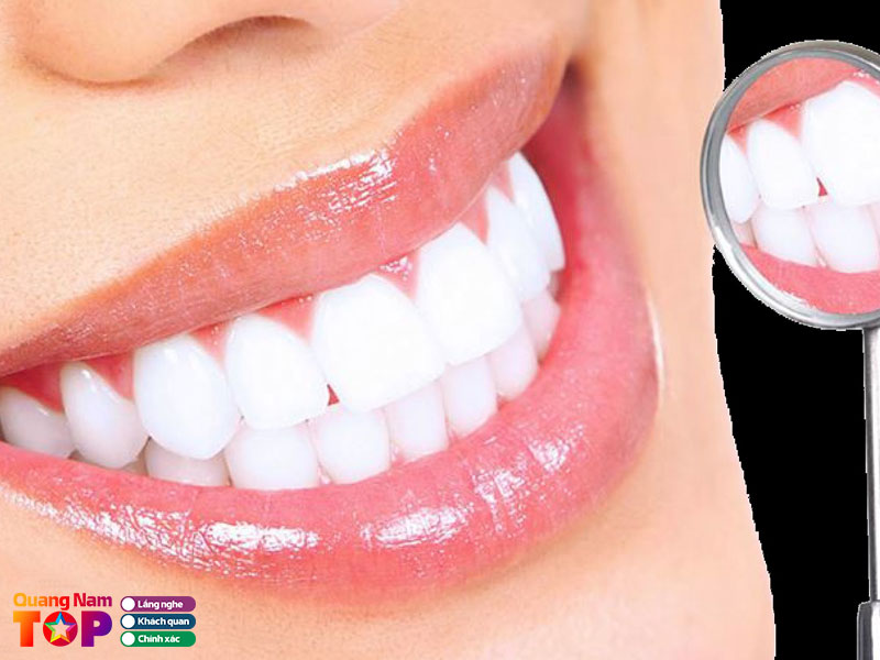 Nu-cuoi-sai-gon-dental-clinic-quangnamtoplist